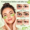60PCS Under Eye Patches for Dark Circles, Aloe Vera Eye