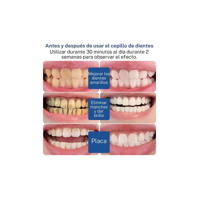 Kit De Blanquear Dientes Lampara Led Gel Dental 7 En