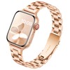 Popular Bands: 1.6 inches (41 mm), 1.6 inches (40 mm),