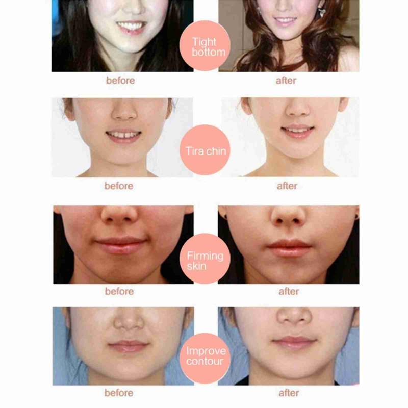 V Shaped Tightening Lifting Face Mask Chin Slimming Nourishing Firming