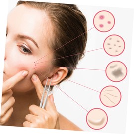 Beavorty 3pcs Stainless Steel Pimple Extractor Tweezers Blackhead Removal Tool for Home Use Smooth Skin Care Safe for All Skin Types