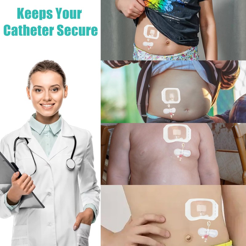 Catheter Stabilization Device,Feeding Tube Holder,Self Adhesive Catheter Holder Patch Dressing