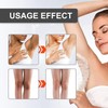 Crema Aclaradora de Partes Intimas de Axilas, Crema para Manchas