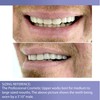 Professional Cosmetic Upper - New from Instant Smile! Hand Crafted