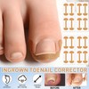 Professional Ingrown Toenail Set with Breathable Ingrown Toenail Strips, Curved