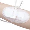 Flosmore 5 Pcs Catheter Stabilization Devices,Catheter Supplies,Foley Catheter Urinary Leg