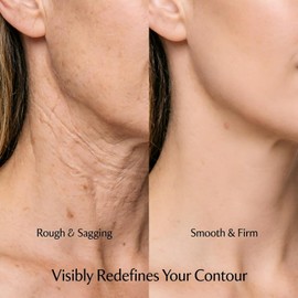 Venlock Firming Neck Cream for Tightening and Lifting - Creamy Skin Deep Wrinkles and Sagging Anti-Aging Moisturizer Hydrating Contour Décolletage Care (1.76 Fl Oz) / 조이고 리프팅을 위한 벤록 펌링 넥 크림 - 크리피 피부 깊은 주름 및 처짐을 안티에이징 모이스처라이저 수분 공급 컨투어 데콜레티지 케어 (1.76 Fl Oz)