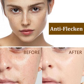 Pigmentflecken Maske, Peel-Off Maske für Strahlende Haut, Pigmentflecken Entferner Gesichtsmaske, Wrapping Mask für Dunkle Flecken, Poren Straffung, Dark Spot Removing Face Mask