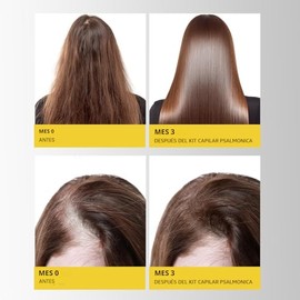 Set de champú y acondicionador para el crecimiento del cabello: sin sulfato para el crecimiento del cabello, activador de raíces, champú espesante par