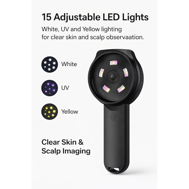 Digital Dermascope for Skin, Up to 500X Viewing, 2.8” IPS