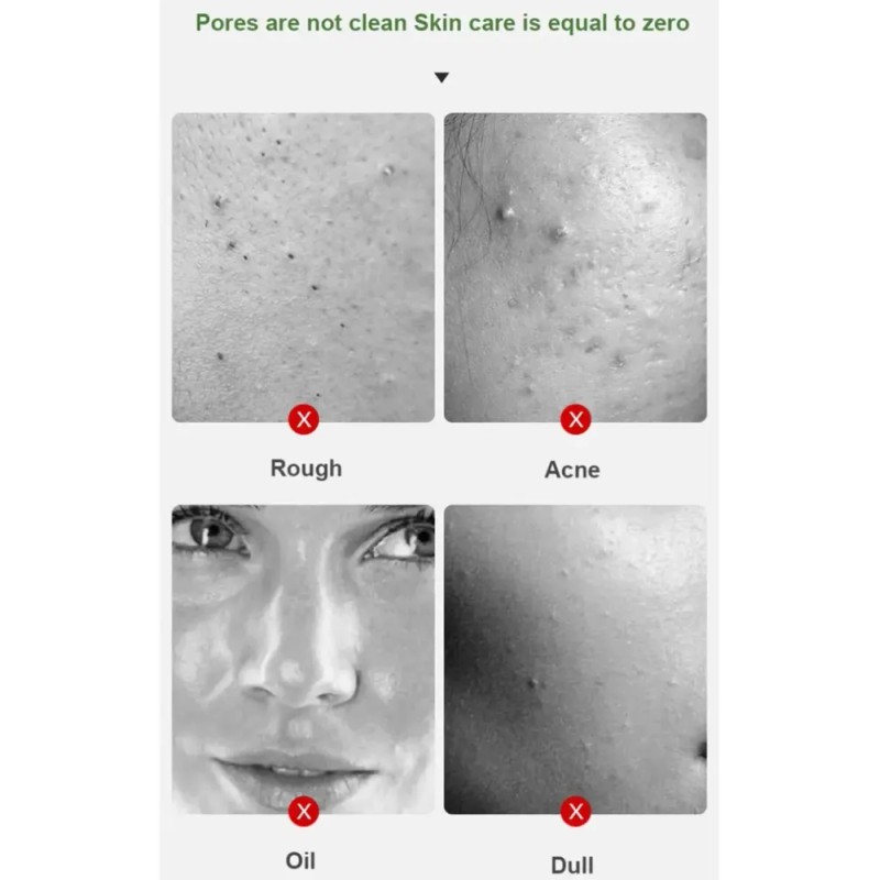 Mascarilla De Té Verde En Barra Para Eliminar Puntos Negros