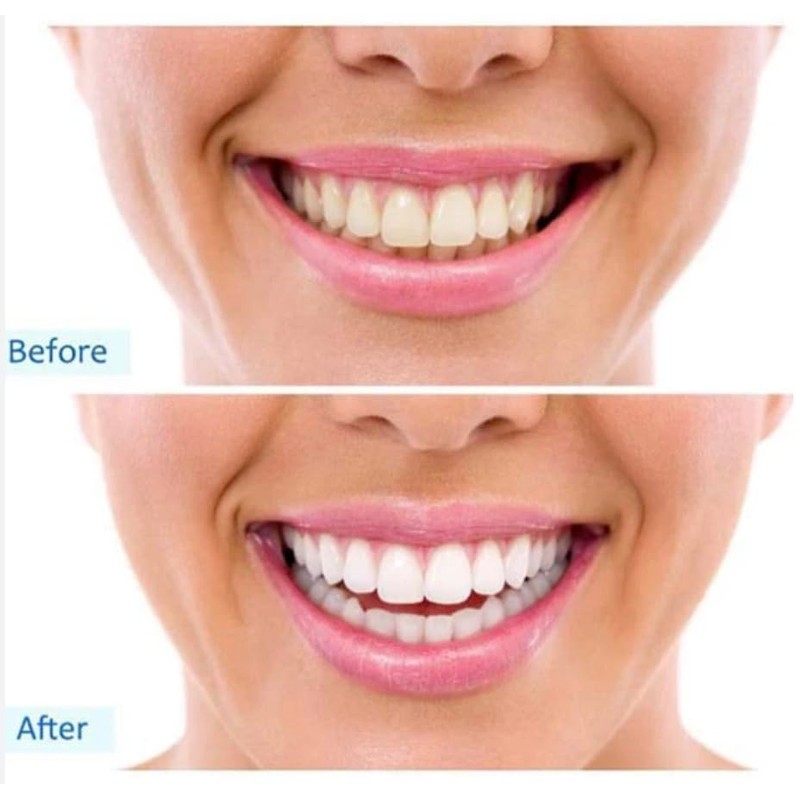 Pepsodent Pepsodent Complete Care Toothpaste Original Flavor 5.5 oz (Pack