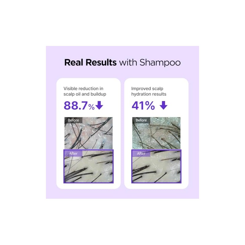 Champú BeConfident solución suave y eficaz contra la caída del