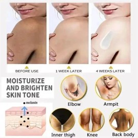*/crema Iluminadora De Nudillos Oscura Para Manos, Codos Y R