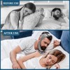 Chin Strap for Sleeping, Anti Snoring Devices, Stop Snoring Solution,