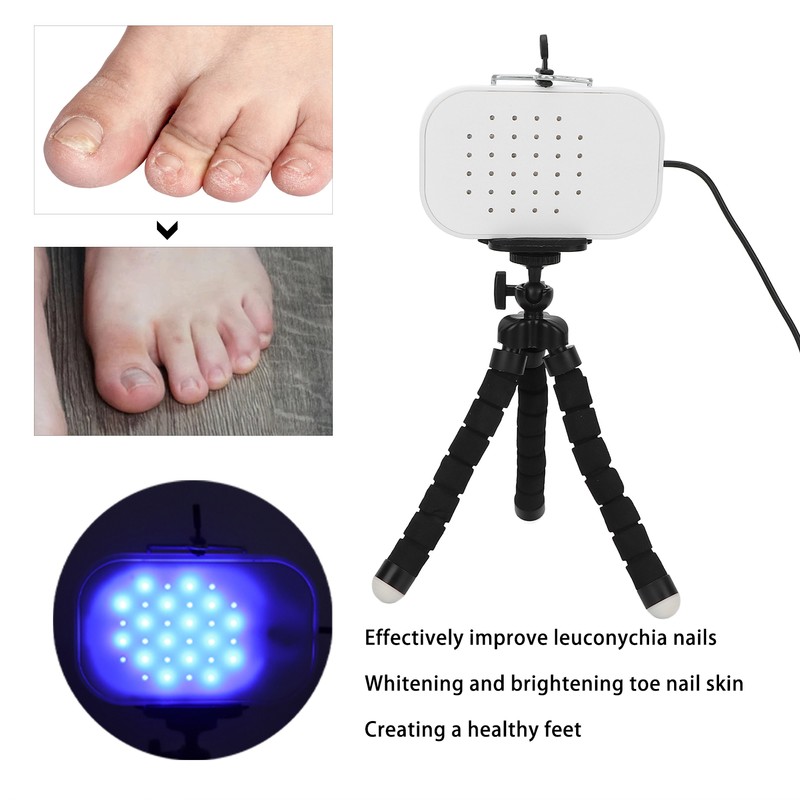 Leuconychia Remover Treatment Device Safe Quick Painless Portable Toe Nails
