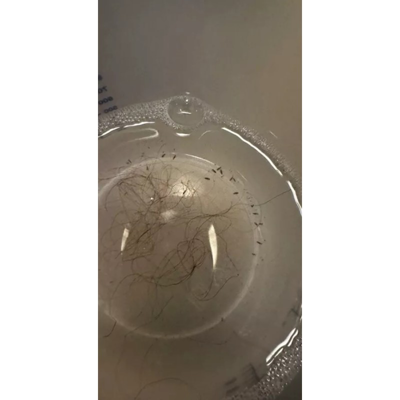 LiceF Head Lice Spray Treatment 6 Fl Oz Professional Metal