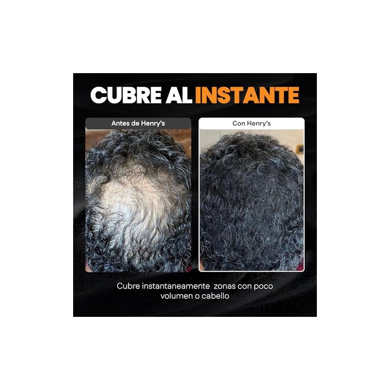 Henrys Kit Fibras Capilares Negro 27.5g con Aplicador, Disimula Áreas