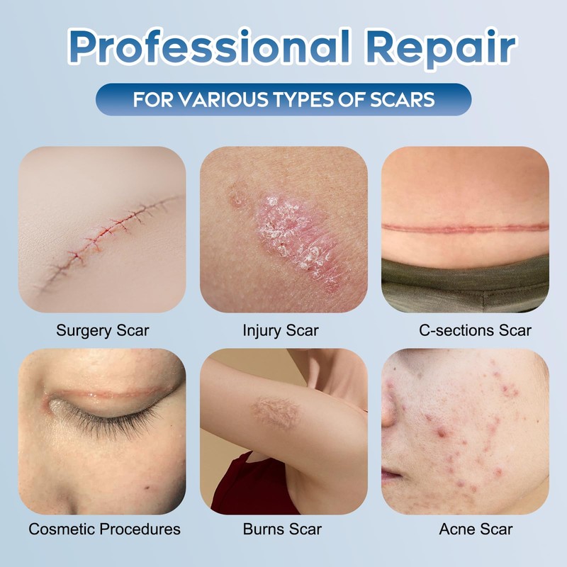 Advanced Silicone Scar Gel for Face & Body – Silicone