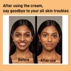 Turmeric Kojic Acid Face Cream- Natural Turmeric Skin Brightening Lotion