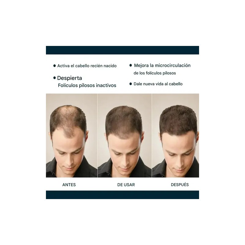 Esencia Anticaída Para El Cuidado Del Cabello Masculino-3pcs