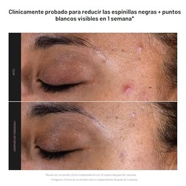 Paula's Choice SKIN PERFECTING 2% BHA Liquid Exfoliant with Salicylic Acid, Facial Polish for Pores, Wrinkles & Fine Lines, Suitable for Blackhead-Prone Skin, Fragrance-Free
