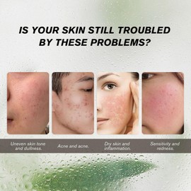 ARCHIDATE Azelaic Acid Serum, Targets Acne, Pimples and Blemishes, Soothe Redness Skin, Deep Cleaning Grease, Controls Oil, Gentle Exfoliation, Azelaic Acid Face Serum for all Skin Type