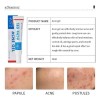 Pak 2 Gel Antiacné Tratamiento Elimina Barros Dia/noche 30ml