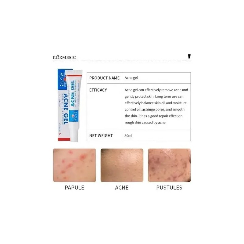 Pak 2 Gel Antiacné Tratamiento Elimina Barros Dia/noche 30ml
