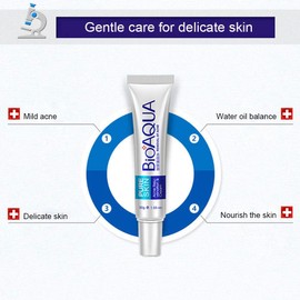 Crema para acné Control de grasa Cuidado con esencias vegetales Mejora la piel Prevención Elimina granitos espinillas puntos blancos y negros Reduce las marcas post-acné Ilumina tez opaca Blanqueamien