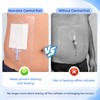10"x12" Dialysis Catheter Shower Cover, 10 Pcs