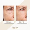Kedma - Set Crema Giorno e Notte al Collagene e