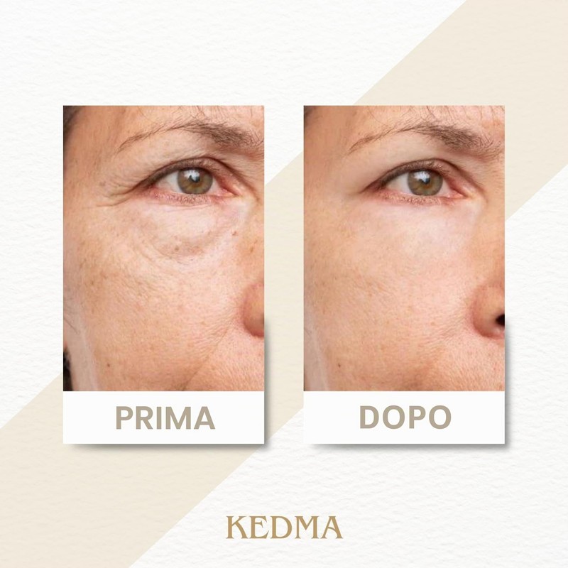 Kedma - Set Crema Giorno e Notte al Collagene e