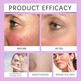 SPF 100 Sunscreen - Spf 100 Sunscreen - Uvb/Uva High Protection spf 100 face Moisturiser - No Sticky Ultra Light UV Protetion Sun Block Face sunscreen for Body and Face