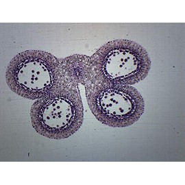 10PK Lilium Anther, 1st Meiotic Division - Prepared Microscope Slides - Classroom Pack, 10 Slides in Storage Case - Biology & Microscopy - Eisco Labs