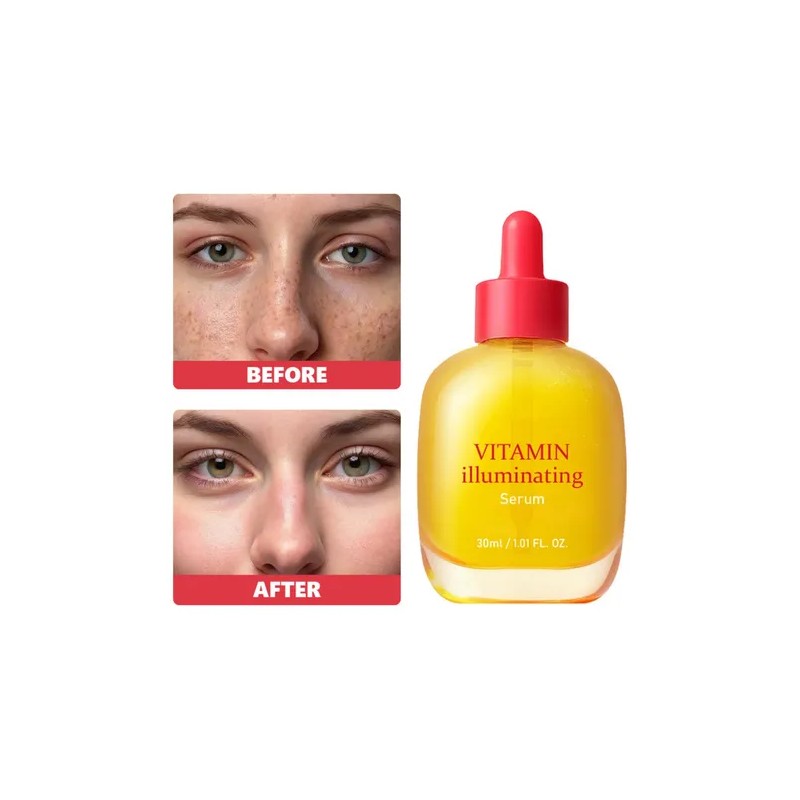Suero Iluminador con Vitamina C Rejuven Vitamin C Brightening Face