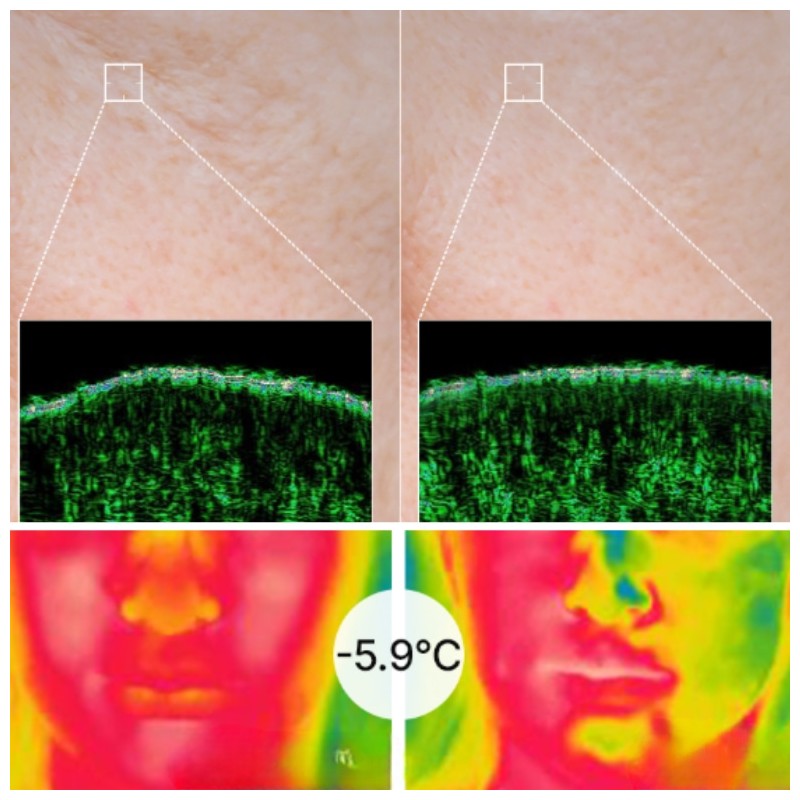 AROCELL TXA Mask + Super Collagen Mask + Botulcare Mask