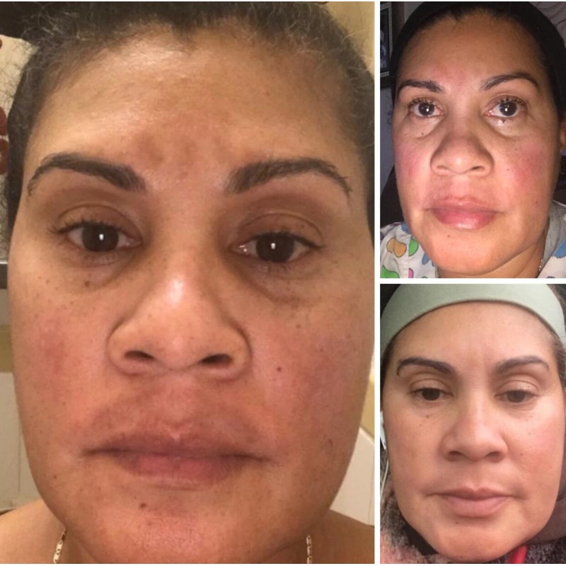 Jacvon LLC Skin Lightener Cream: Para Piel Morena o India