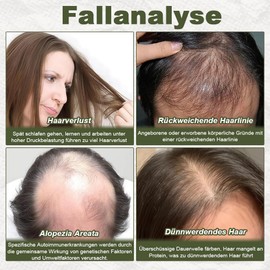 Tyafzzn Tyafzzn Natürliches Haaröl, Veganic Hair Oil zum Haarwachstum Beschleunigen mit Biologischen Rosmarinöl, Rizinusöl, Mandelöl und Arganöl, als Haarmaske und Haarkur