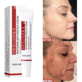 Crema Facial Despigmentante Y Anti Manchas Pack 2 Pzs Todo