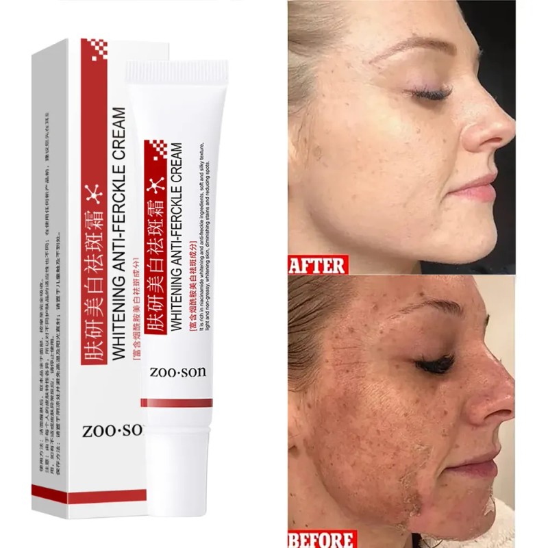 Crema Facial Despigmentante Y Anti Manchas Pack 2 Pzs Todo