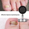 Onychomycosis Treatment Light Toenail Fingernail Care Painless Onychomycosis Remover Device