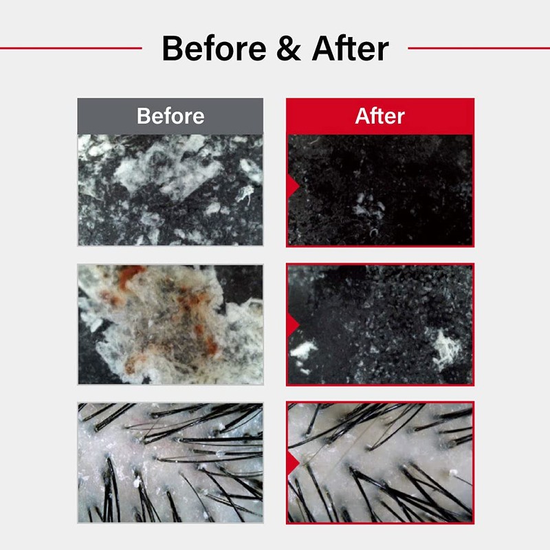 Dr.FORHAIR Folligen Sea Salt Scaler Biotin Scalp Scrub (10.5oz) Hair