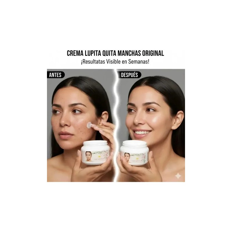 Crema Lupita Original 50ml Anti Manchas Acne Facial Axila Ca