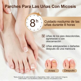 Parches Cuidado para Uñas de Pies, Mejorar el Aspecto de las Uñas