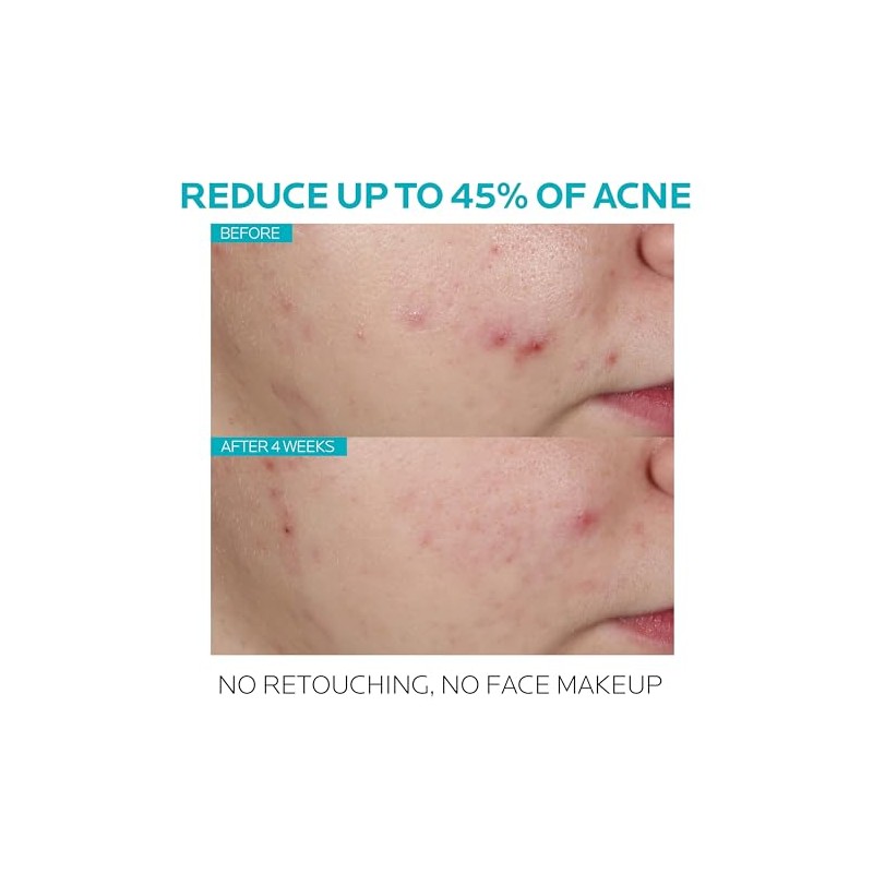 La Roche-posay Effaclar Pore-refining Anti-wrinkle Serum, 1.01 Fluid Ounce