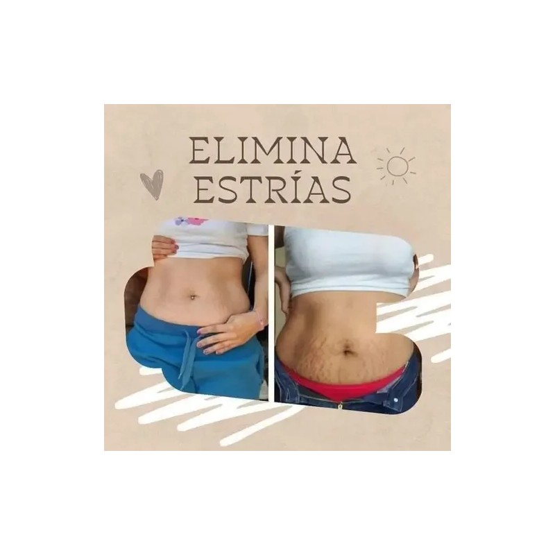 Farmasi Gel Paprika Y Chilereduce Estrías Kit De 3 Piezas