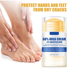 Urea Foot Cream, Urea Cream 60 Percent for Feet, Foot Cream for Cracked Heels and Dry Skin, Skin Care Hands & Feet, Cracked Heel Repair Cream, Foot Moisturiser (2pcs)
