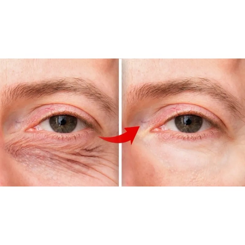 Crema Btx Ojos Sheló Tratamiento Especial Facial