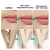 Extra Strong Permanent Hair Removal Spray Stop Hair Growth Inhibitor